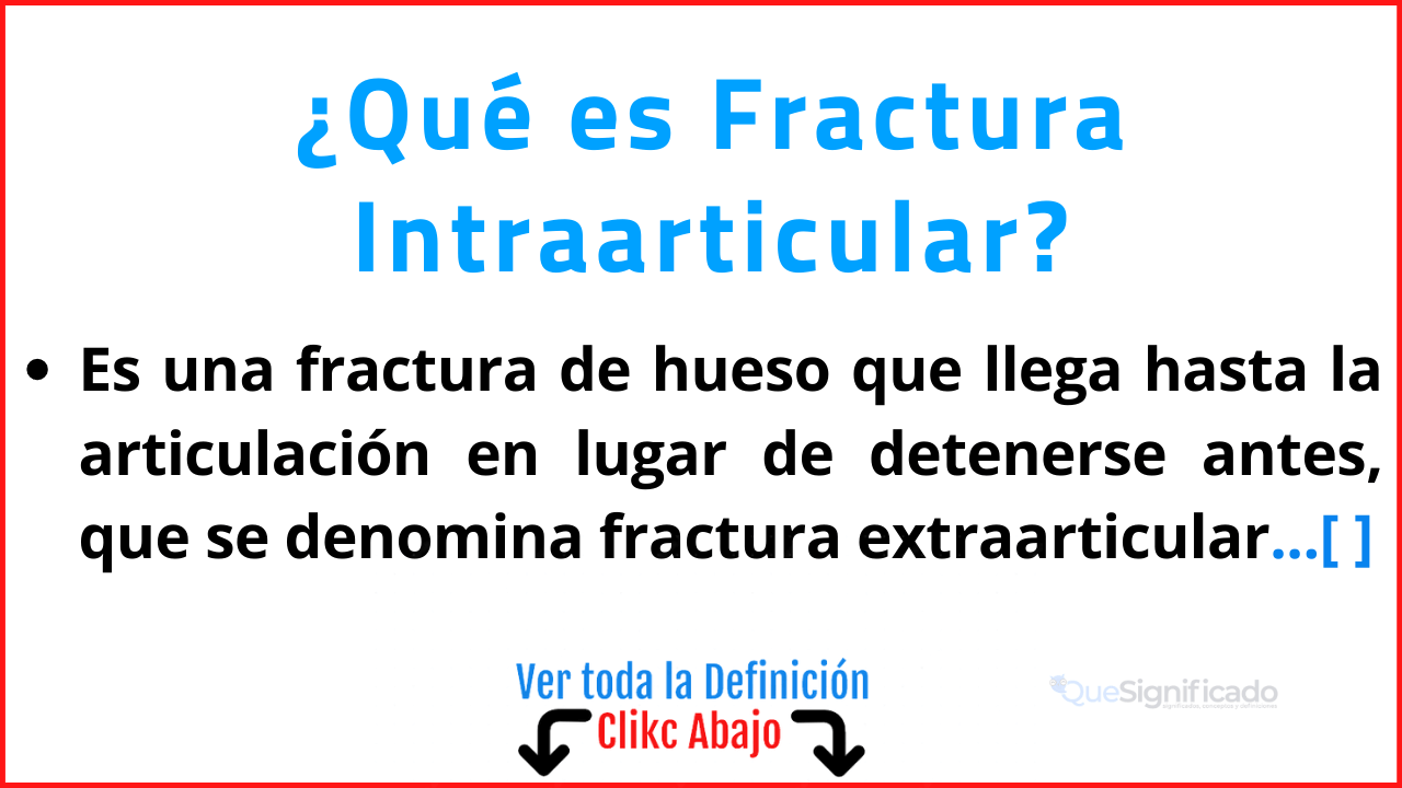 Qué es Fractura Intraarticular