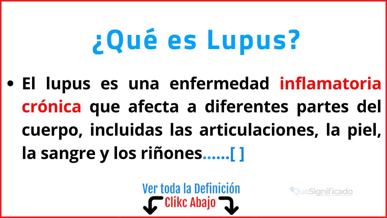 Qué es Lupus